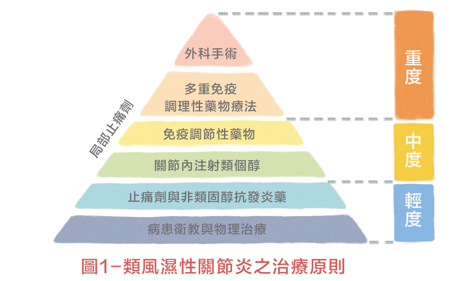 膝關節的保守治療 骨哥論壇