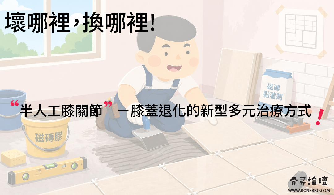 半人工膝關節,壞哪裡,換哪裡