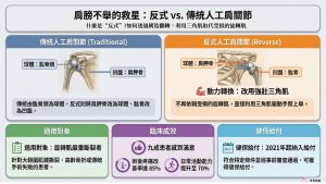 傳統解剖型人工肩關節與反式人工肩關節比較表